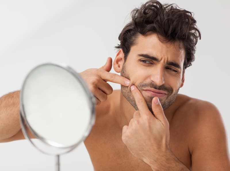 Do Acne Products Affect Facial Hair Growth