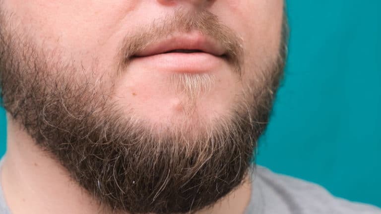 Why Isnt Your Beard Growing On Your Jawline