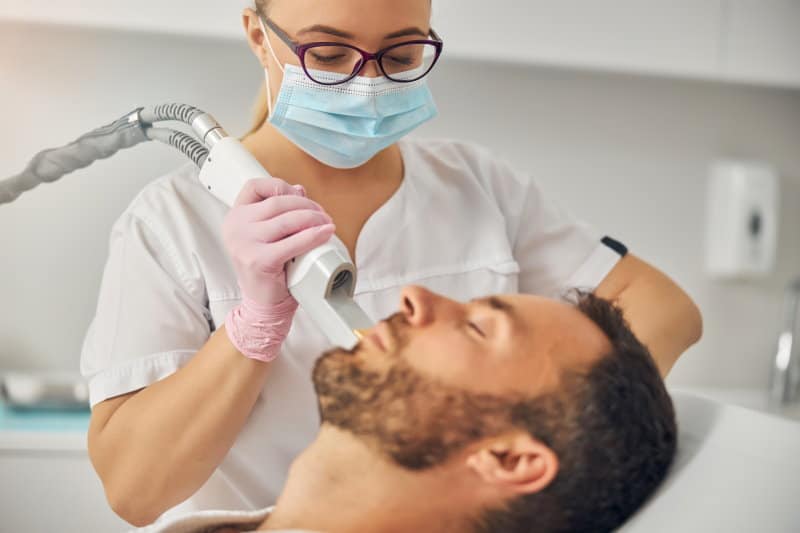 Beard Laser treatment