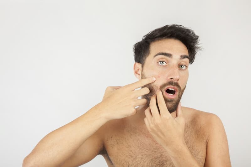 Can Beard Oil Cause Acne? Here’s The Truth!