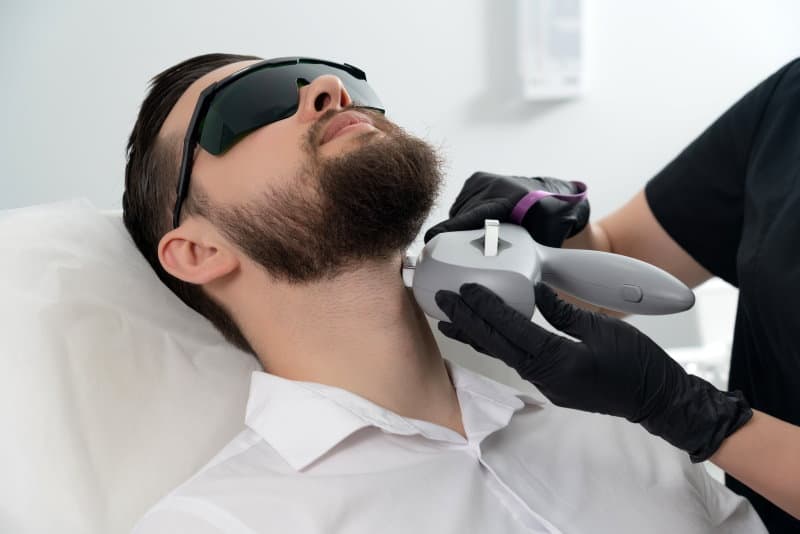 Laser Treatments for beard growth