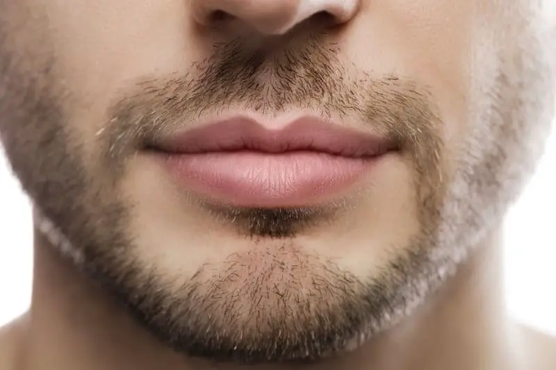 What Should You Expect From Beard Transplant Surgery